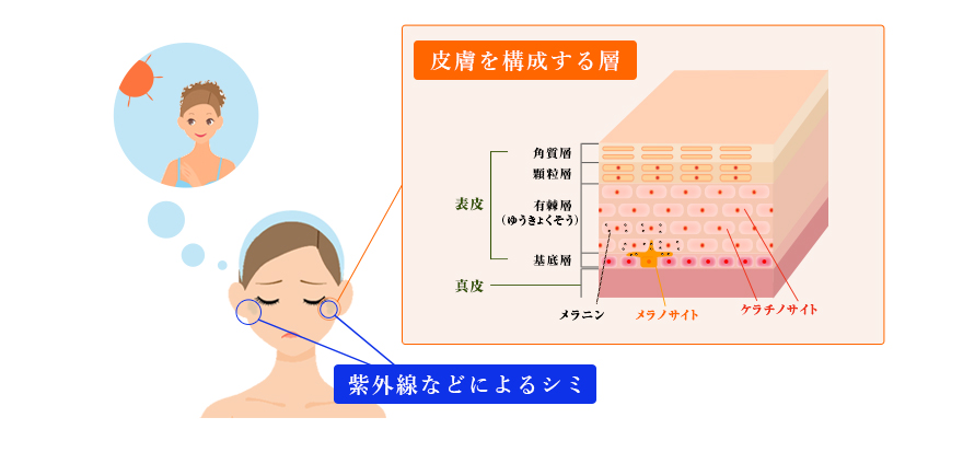 肌のシミの予防と対策