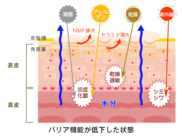 冷えと婦人病の関係
